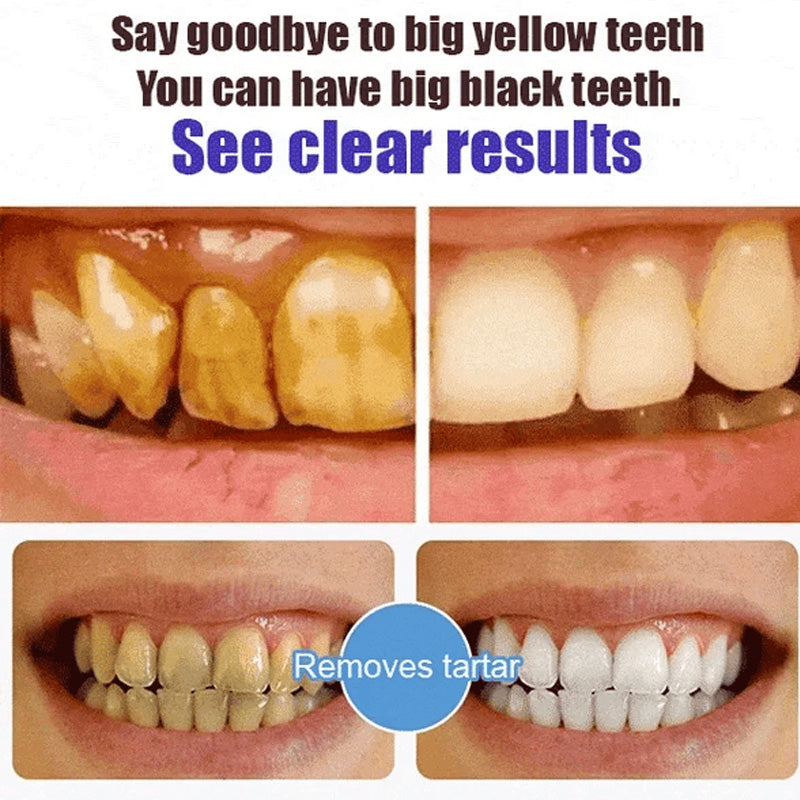 🦷 Probiotic-6 Advanced Oral Care Toothpaste