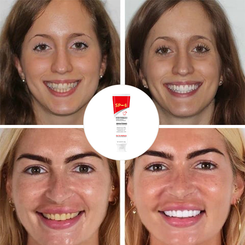 🦷 Probiotic-6 Advanced Oral Care Toothpaste