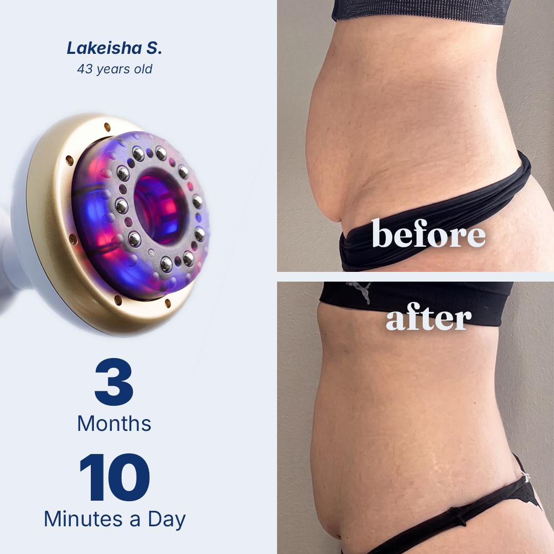 Wearnovique Beauty Massage Device