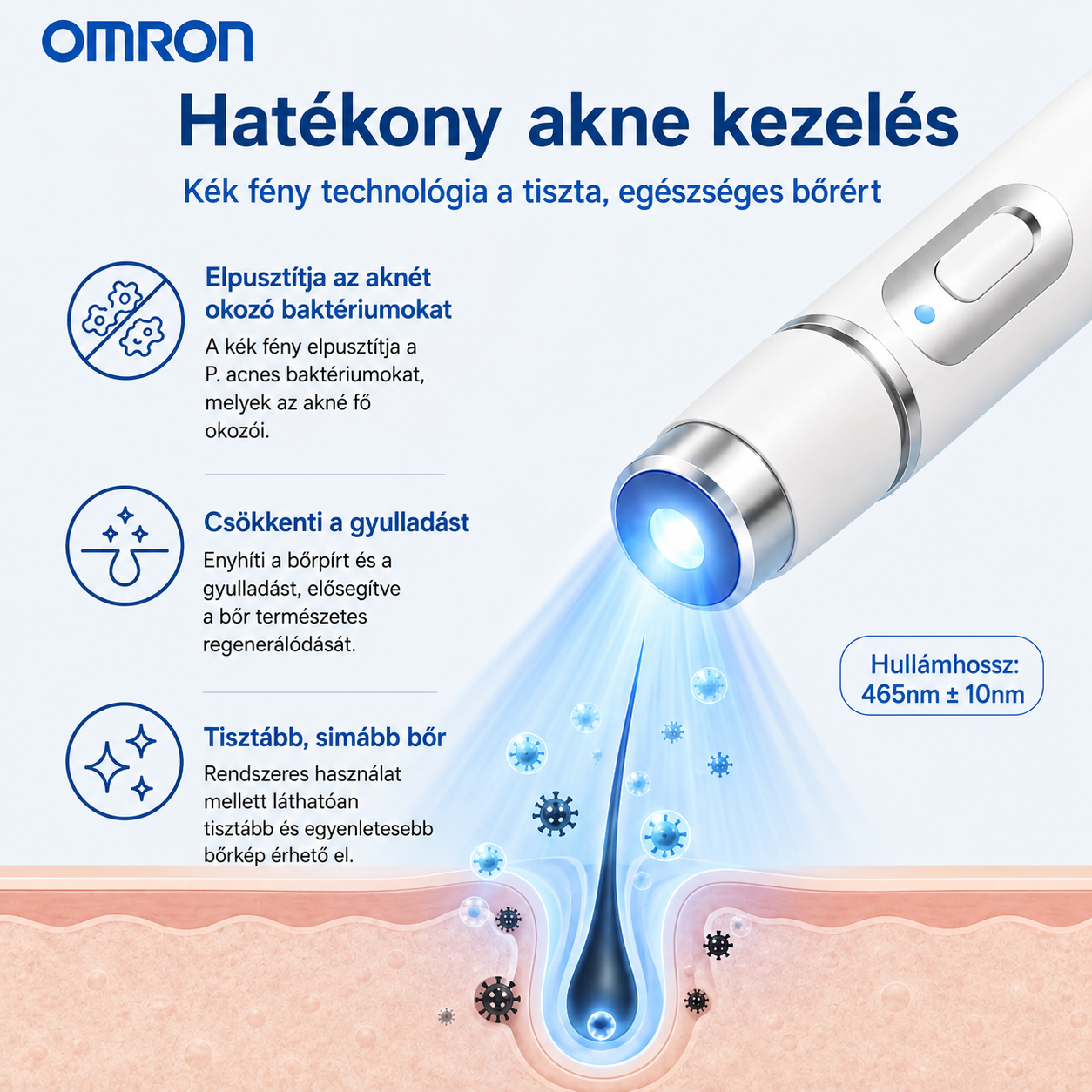 Omron® non-invazív anyajegy- és szemölcseltávolító lézertoll✨