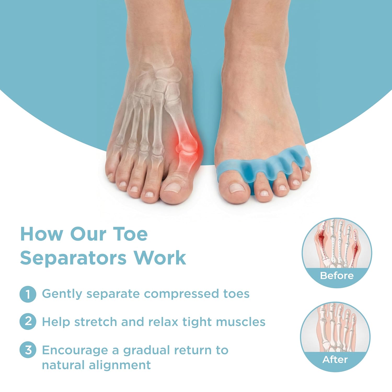 Toe Separators