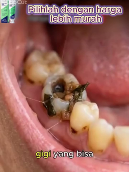 🦷 Japoński sekret zdrowego uśmiechu! Rewolucyjna pasta odbudowująca szkliwo 