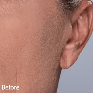 Before and after product