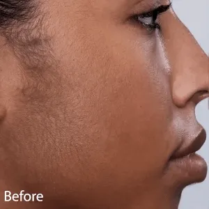 Before and after product