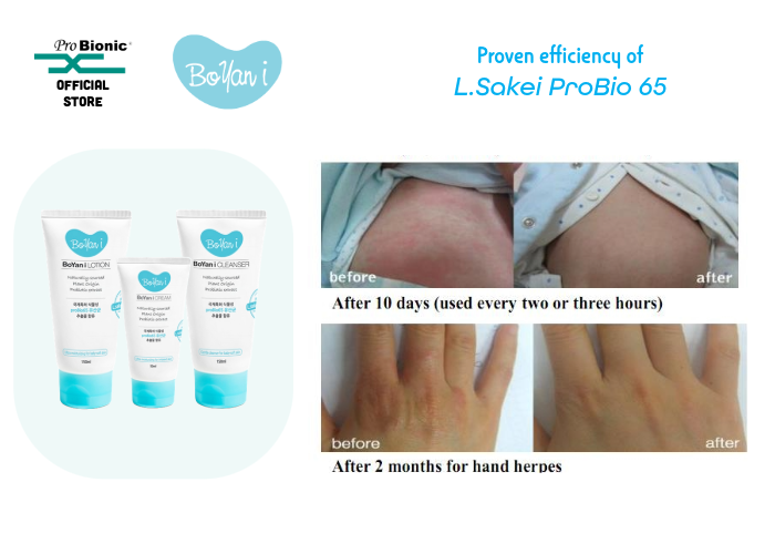 Boyan I Cream | Korean Microbiome Cream for Sensitive, Dry & Eczema-Prone Skin