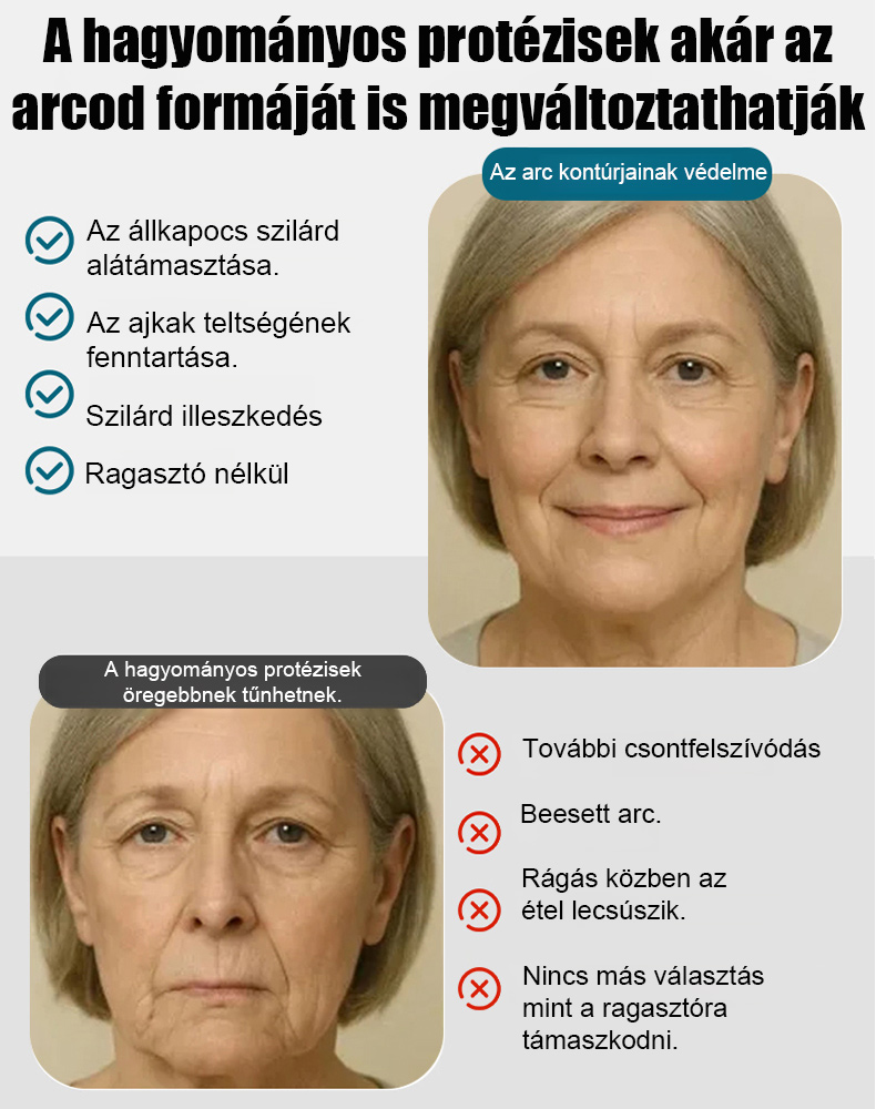 Elasztikus fogsorbetét pillanatok alatt tökéletes mosolyt ad!