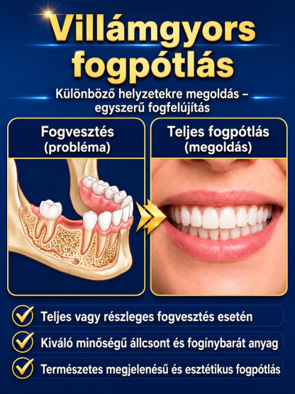 Hivatalos újdonság! Rugalmas műfogsor készlet tökéletes illeszkedéssel!