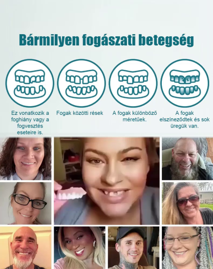 Elasztikus fogsorbetét pillanatok alatt tökéletes mosolyt ad!