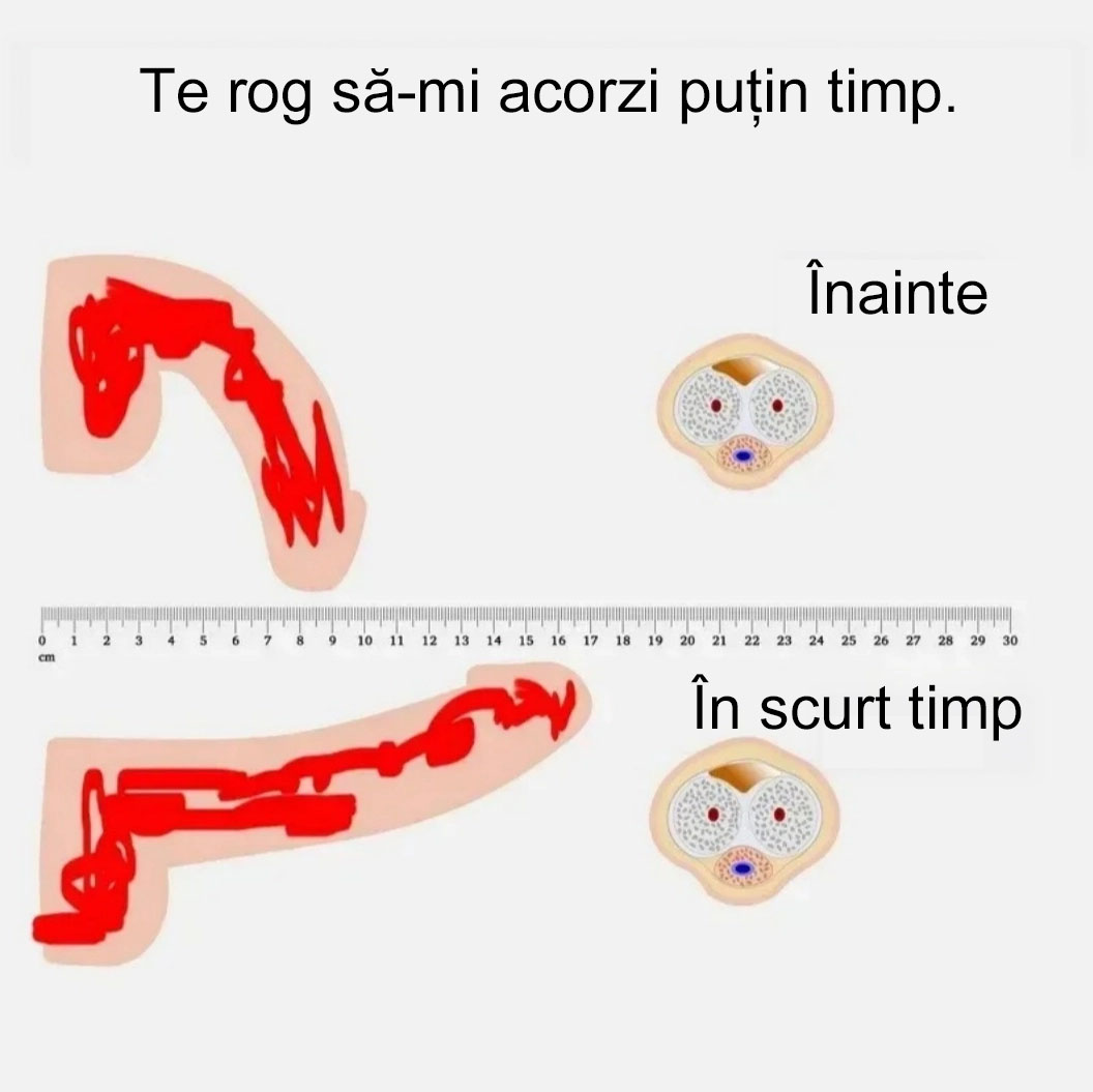 罗马尼亚Picături Anniecare® PRO pentru vitalitate masculină – Secretul din buzunarul tău