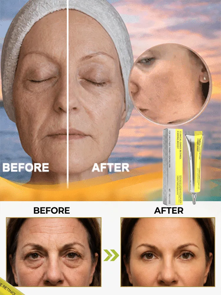 👁️ Dermatologist-Tested Clinical Retinol Eye Cream Lifts Wrinkles In 7 Days – 50% OFF Flash Sale With 30-Day Free Trial & 10x Ineffective Payout Guarantee!