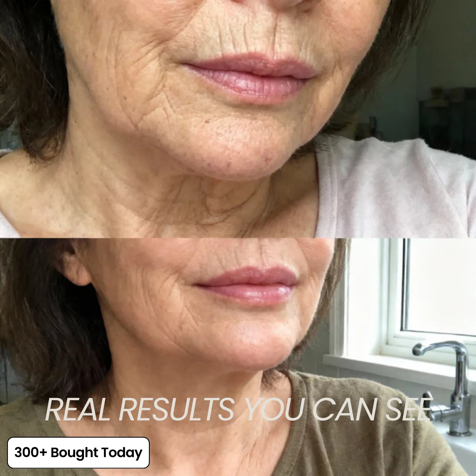 🔥LAST DAY 60% OFF🔥Labs Korean Pink Collagen Volume Multi Balm