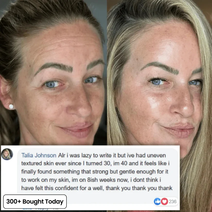 🔥LAST DAY 60% OFF!!Brightening Cream