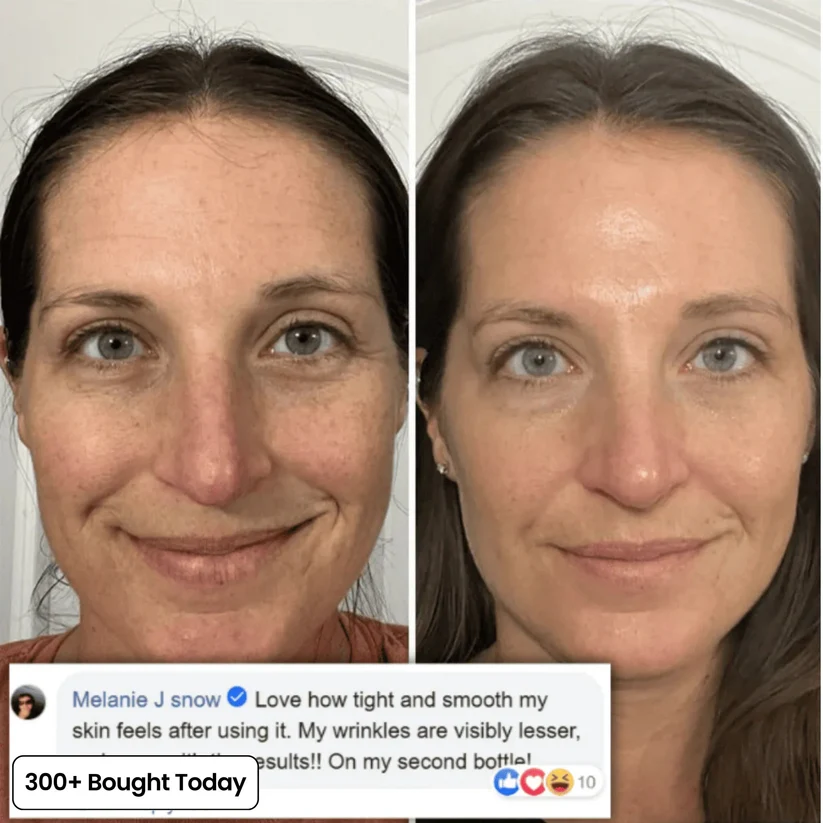 🔥LAST DAY 60% OFF!!Brightening Cream