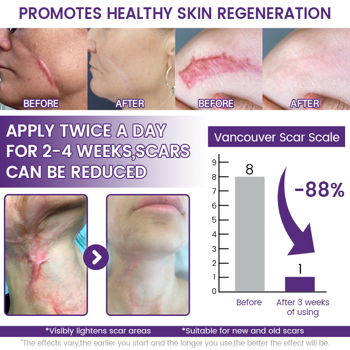 【 HREB & VITAL Official Store 】 SkinRenew Smoothing Gel