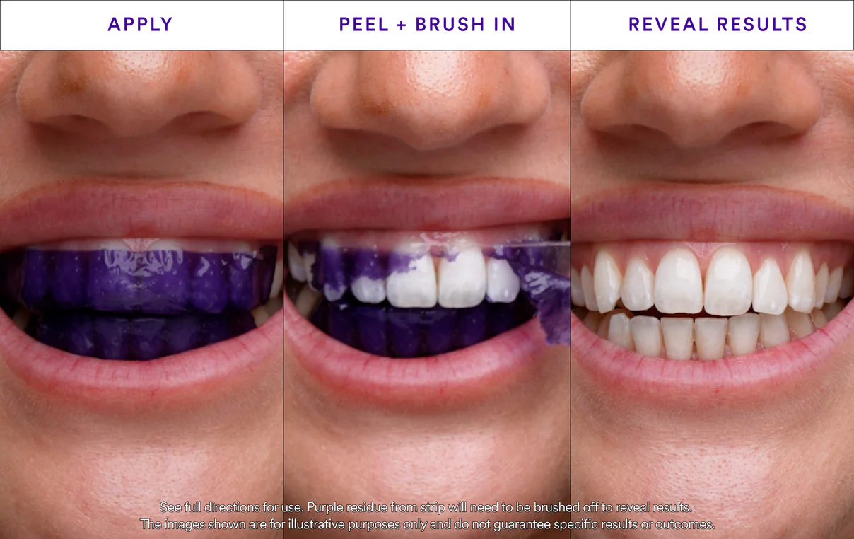 V34 Whitening Strips-Aldronix
