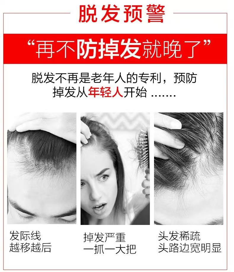 Yuqingtang Anti-Hair Loss and Hair Strengthening Shampoo 500ml/bottle