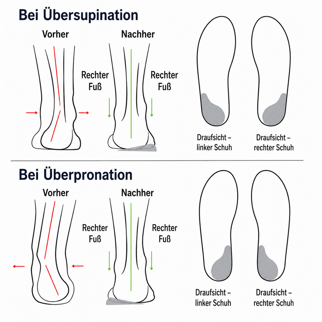 Bequeme Keilsandalen f&uuml;r Damen &ndash;Details