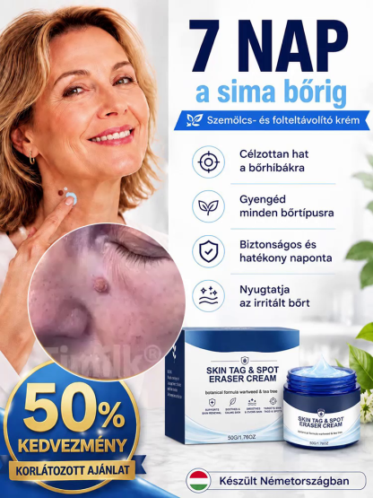 👍Prémium Bőrhiba Eltávolító Krém – Fájdalommentes és Természetes Formula (50% Akció)