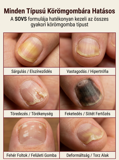 Intenzív Körömápoló Folyadék (50% Akció) - Egészséges Körmök