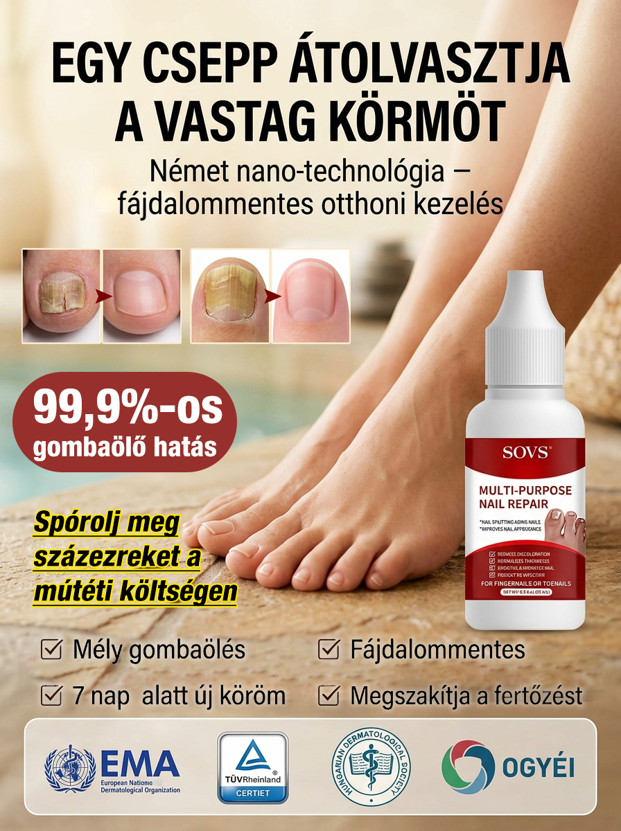 Intenzív Körömápoló Folyadék (50% Akció) - Egészséges Körmök
