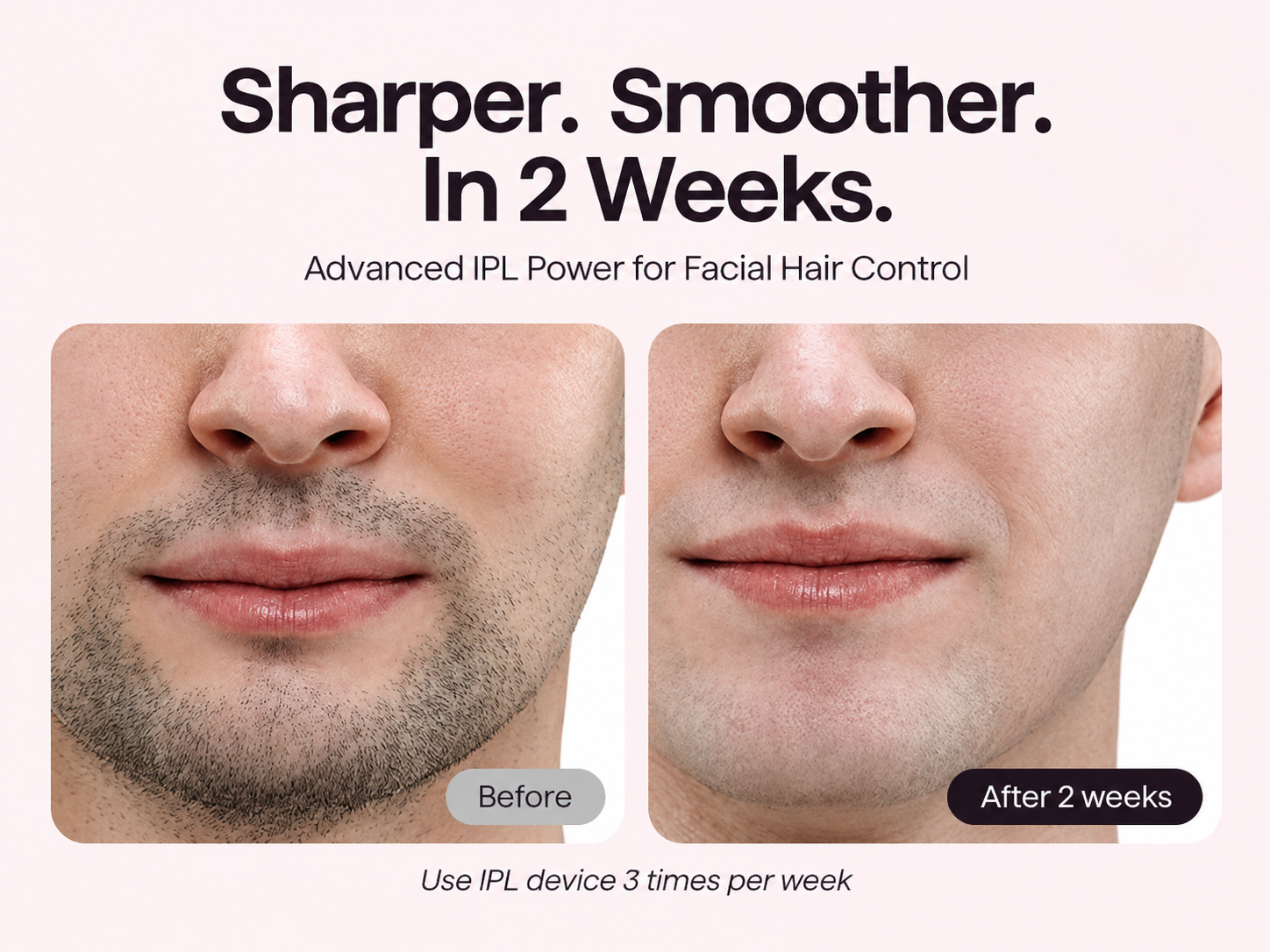 Facial Hair Treatment