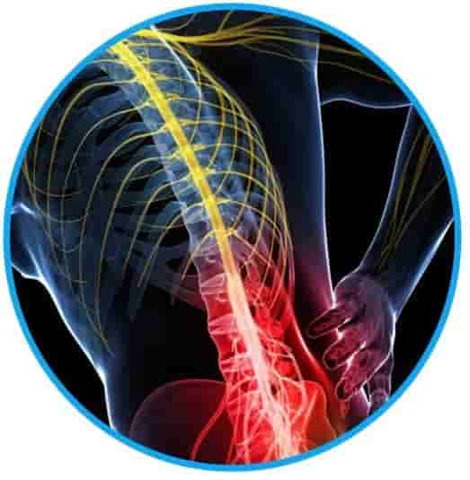 Chronic back pain