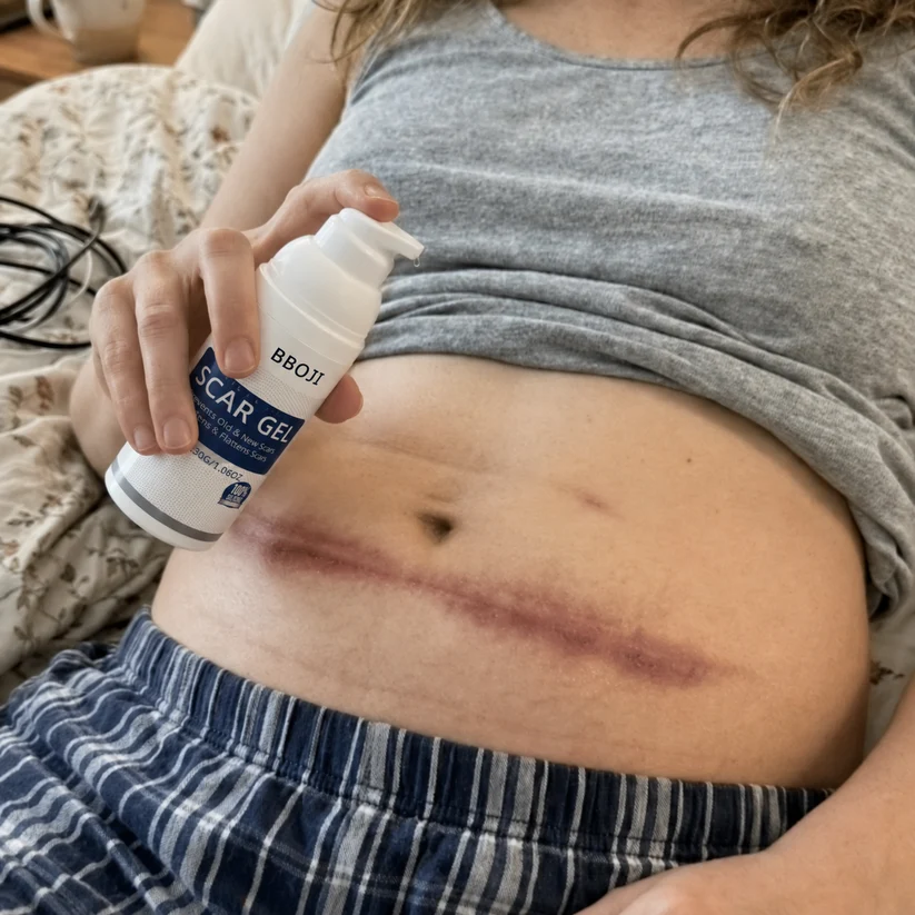 Żel silikonowy na blizny. Spłaszcza. Zmiękcza. Rozjaśnia. – Terapia blizn zalecana przez farmaceutów