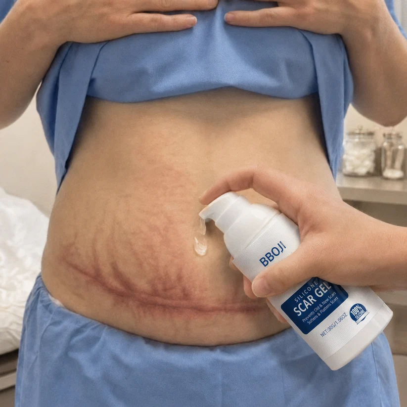 Żel silikonowy na blizny. Spłaszcza. Zmiękcza. Rozjaśnia. – Terapia blizn zalecana przez farmaceutów
