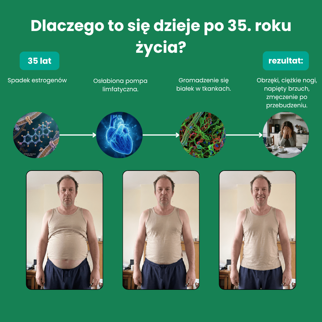Drenaż limfatyczny - Poczuj się mniej wzdęty