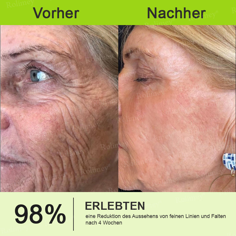 Rolimey® Retinol & Botox Shot ✓ Dermatologisch getestete Lifting-Creme