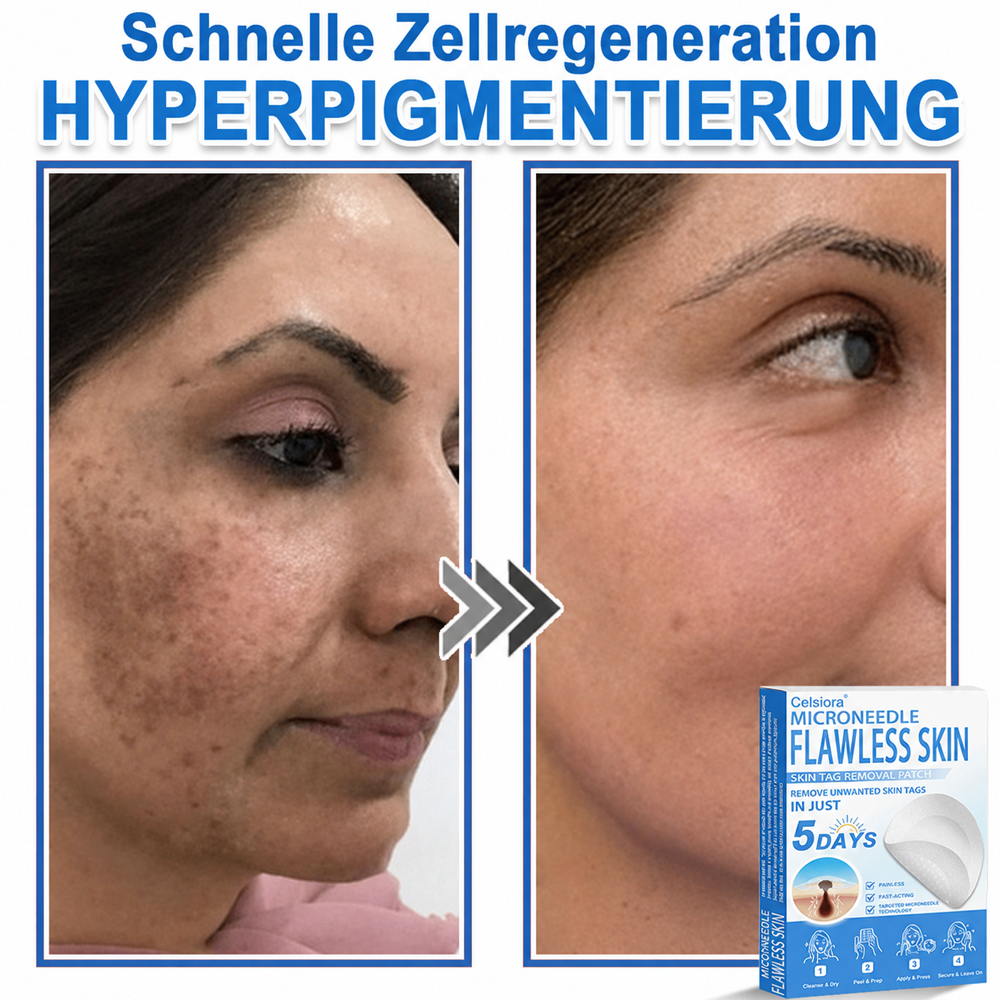 ⭐Celsiora® 2-in-1 Mikronadel- & Hydrokolloid-Pflaster | Entferner für erhabene Muttermale, Akne, flache Warzen & Hautanhängsel | Verbessert Falten, Narben & Hautunreinheiten | Unsichtbare Stern-Pickelpflaster für Gesicht & Körper