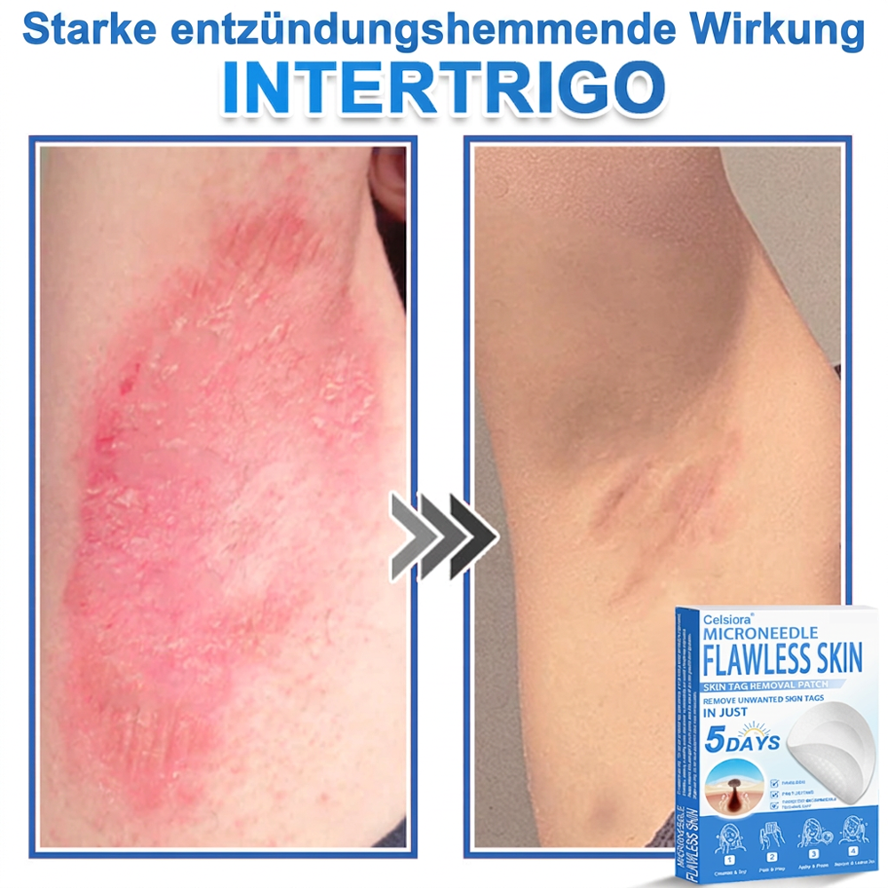 ⭐Celsiora® 2-in-1 Mikronadel- & Hydrokolloid-Pflaster | Entferner für erhabene Muttermale, Akne, flache Warzen & Hautanhängsel | Verbessert Falten, Narben & Hautunreinheiten | Unsichtbare Stern-Pickelpflaster für Gesicht & Körper