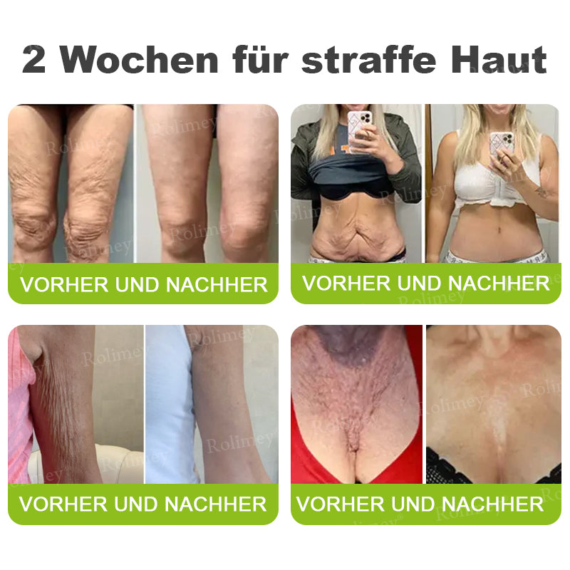 Rolimey® Retinol & Botox Shot ✓ Dermatologisch getestete Lifting-Creme