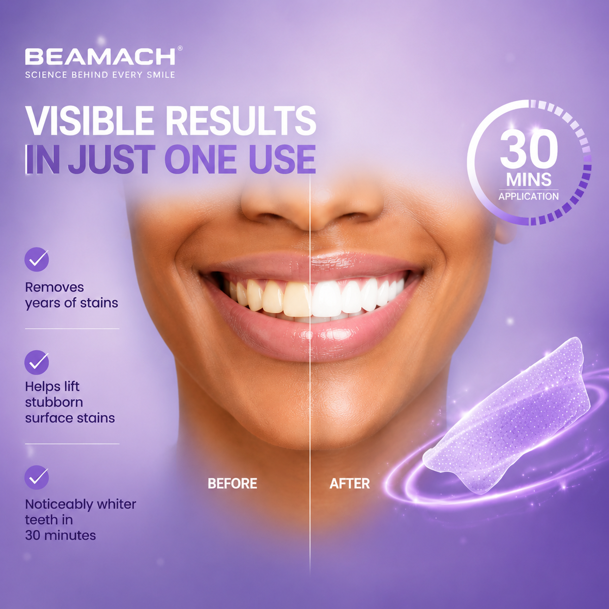 Beamach Purple Tone-Correcting Mouthwash — 30-Second Instant Brightening