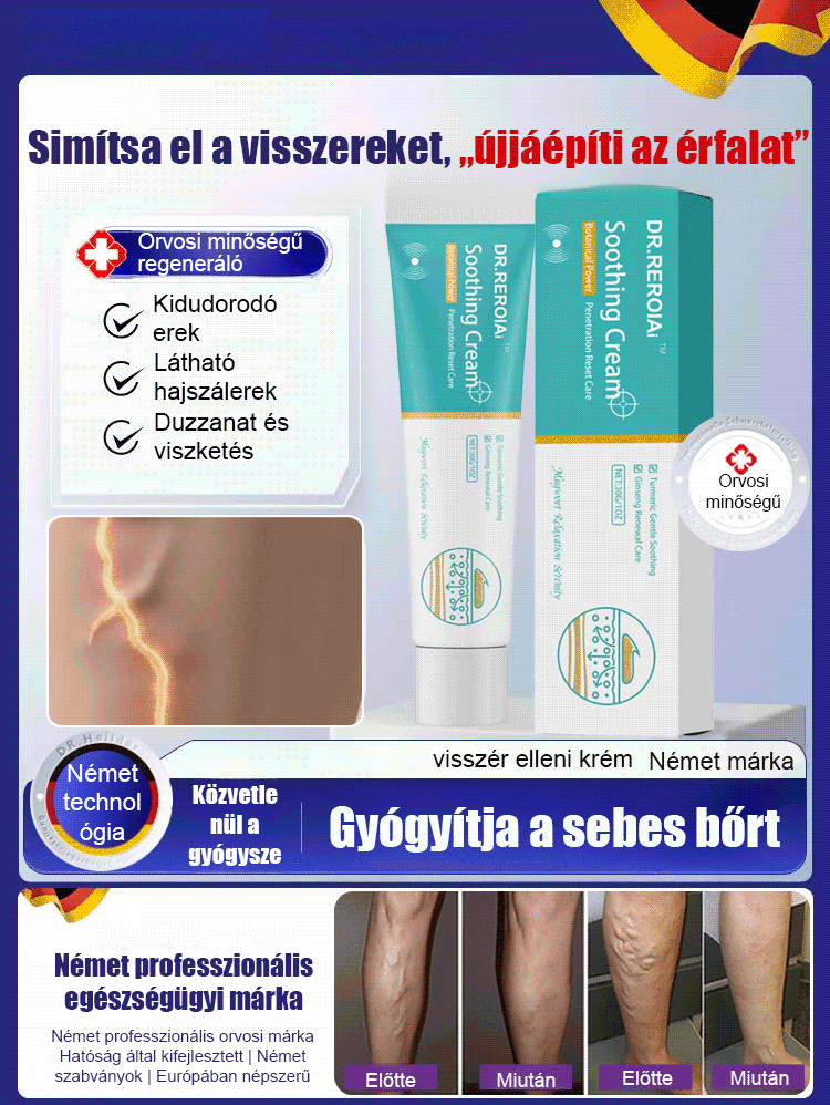 [KUP 1 ZGARNIJ 1 GRATIS] Krem Chłodzący do Nóg - Ulga dla Ciężkich Nóg i Pajączków (75% OFF)