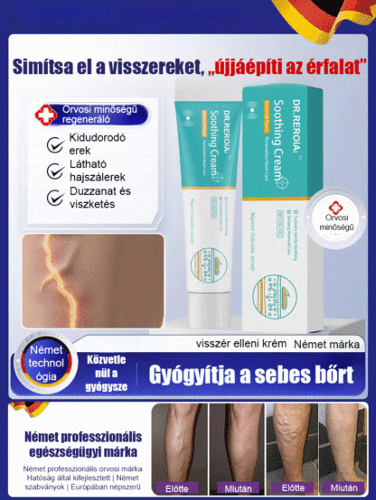 [KUP 1 ZGARNIJ 1 GRATIS] Krem Chłodzący do Nóg - Ulga dla Ciężkich Nóg i Pajączków (75% OFF)