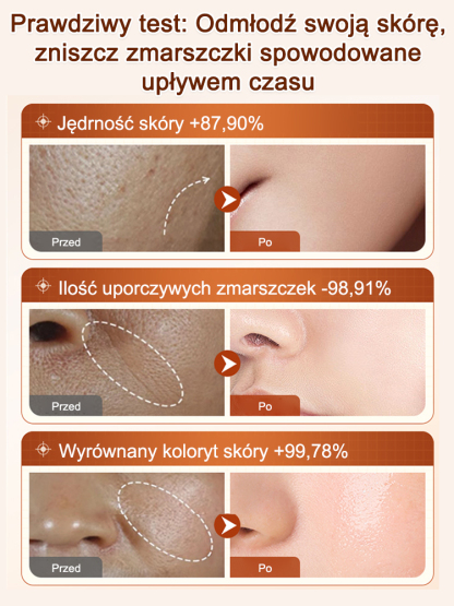 Skoncentrowane Serum Przeciwzmarszczkowe | Efekt Liftingu Bez Skalpela (-50%)
