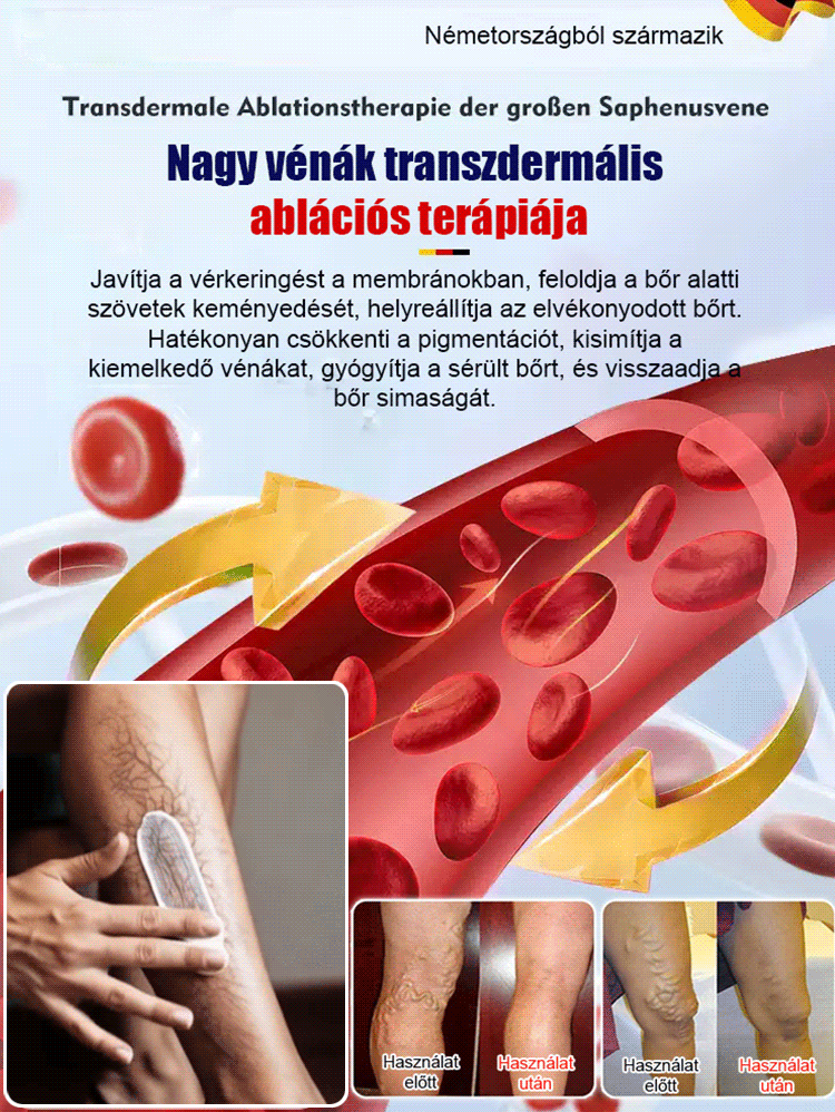 [KUP 1 ZGARNIJ 1 GRATIS] Krem Chłodzący do Nóg - Ulga dla Ciężkich Nóg i Pajączków (75% OFF)