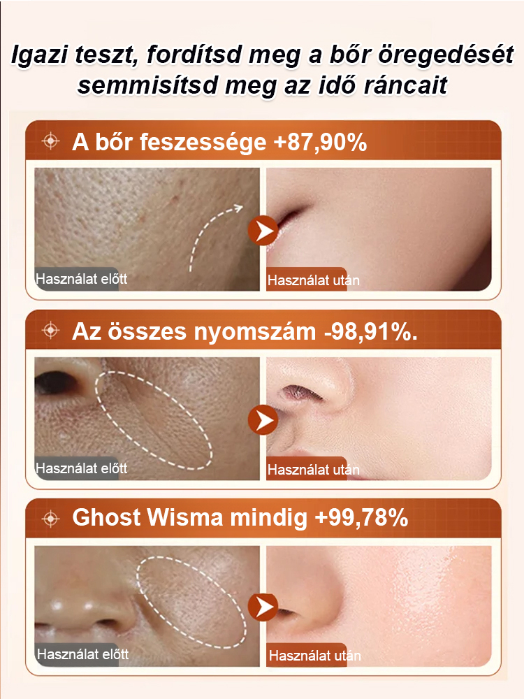 Koncentrált Ránctalanító Szérum | Azonnali Lifting Hatás Tűk Nélkül (-50%)