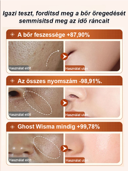 Koncentrált Ránctalanító Szérum | Azonnali Lifting Hatás Tűk Nélkül (-50%)