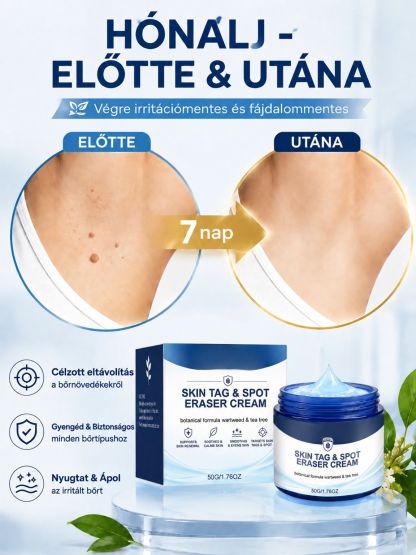 Német Formulájú Bőrhibajavító Krém | -50% Akció + Ingyenes Szállítás
