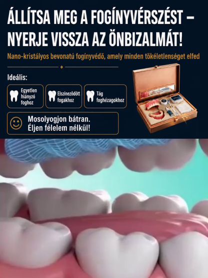Azonnali Tökéletes Mosoly Kozmetikai Fogsor 📦Utánvét + 80% Kedvezmény