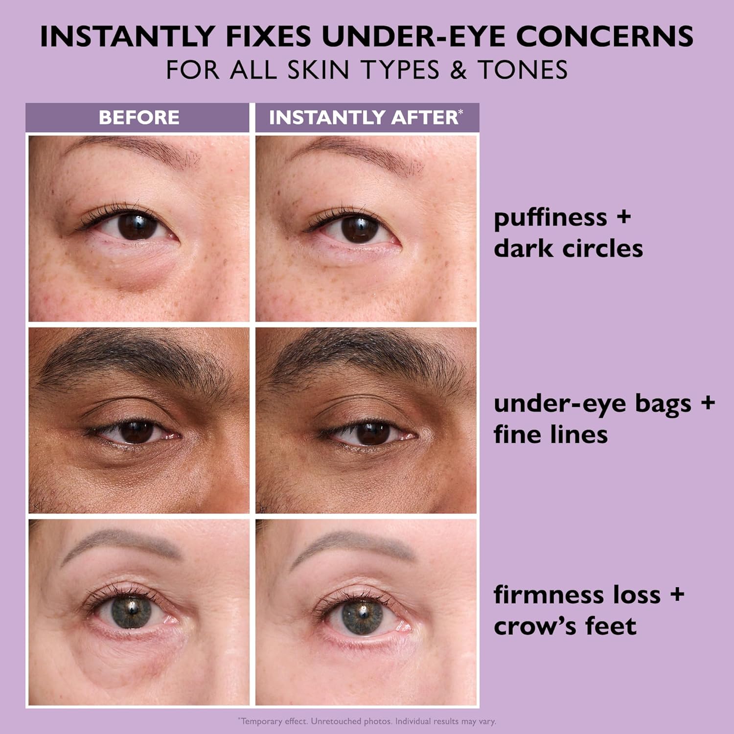 VELLARISSKIN™ Instant Eye Tightener | Smooths Under-Eye Bags & Fine Lines