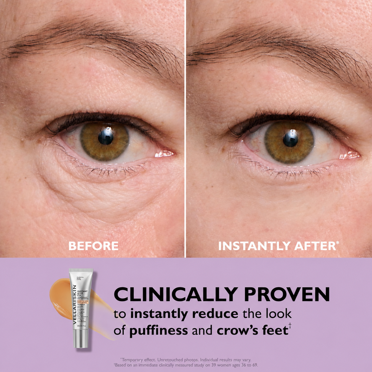 VELLARISSKIN™ Instant Eye Tightener | Smooths Under-Eye Bags & Fine Lines