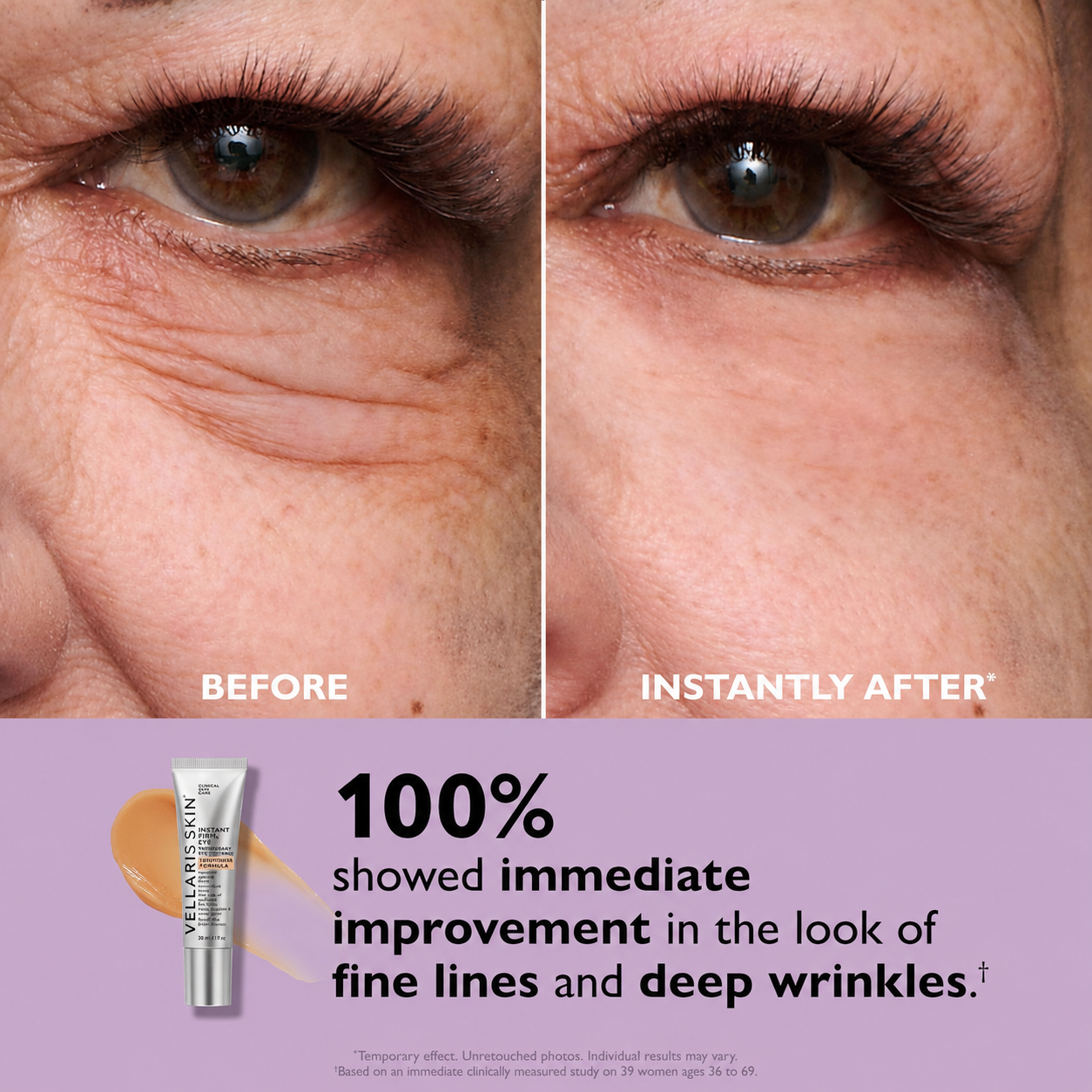 VELLARISSKIN™ Instant Eye Tightener | Smooths Under-Eye Bags & Fine Lines