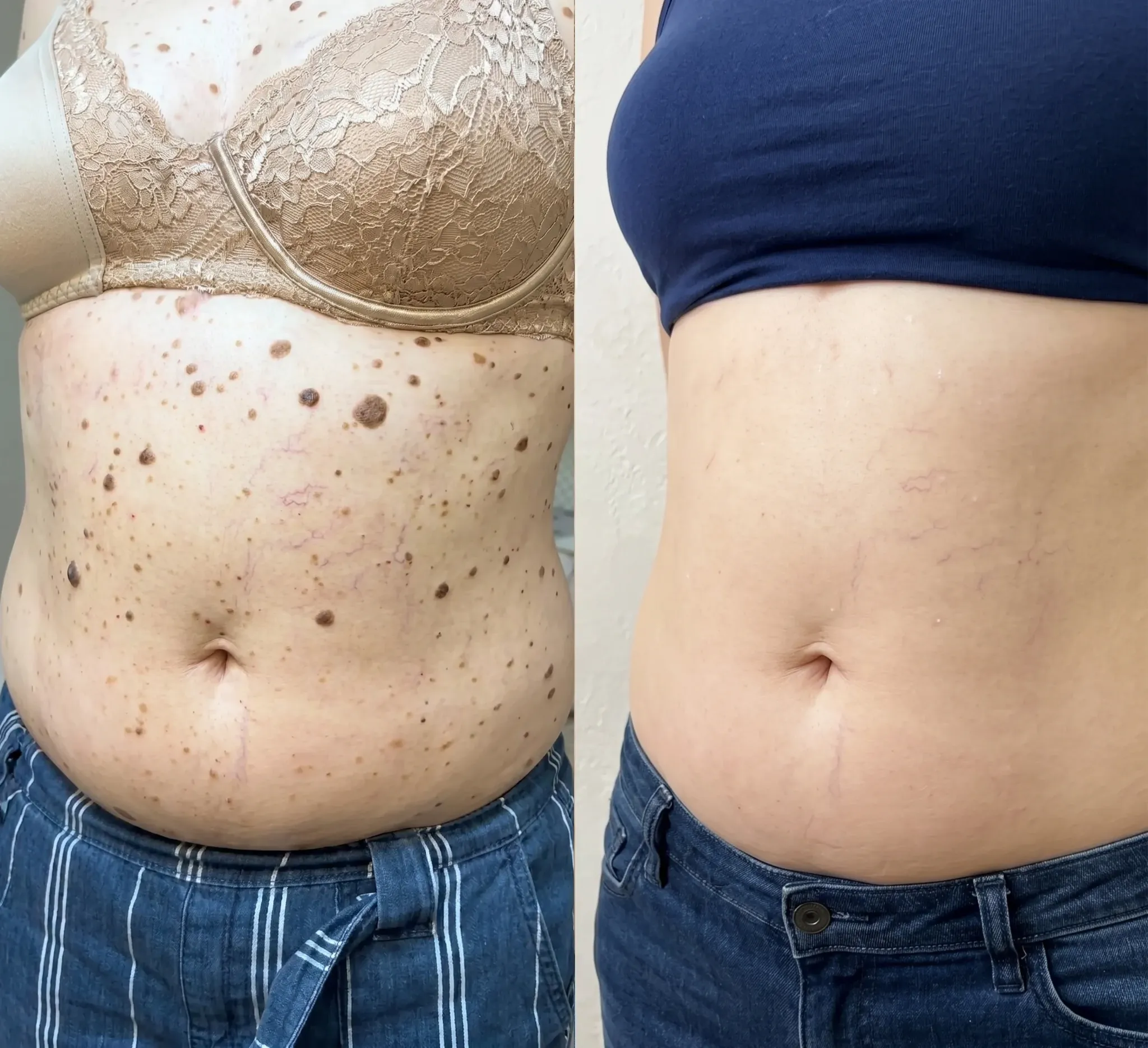 Customer result photo