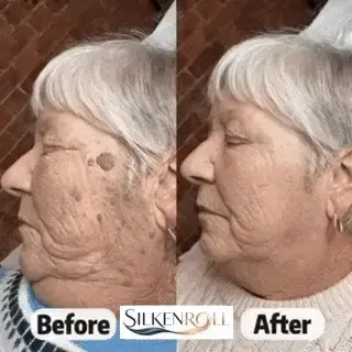 Before and after appearance example