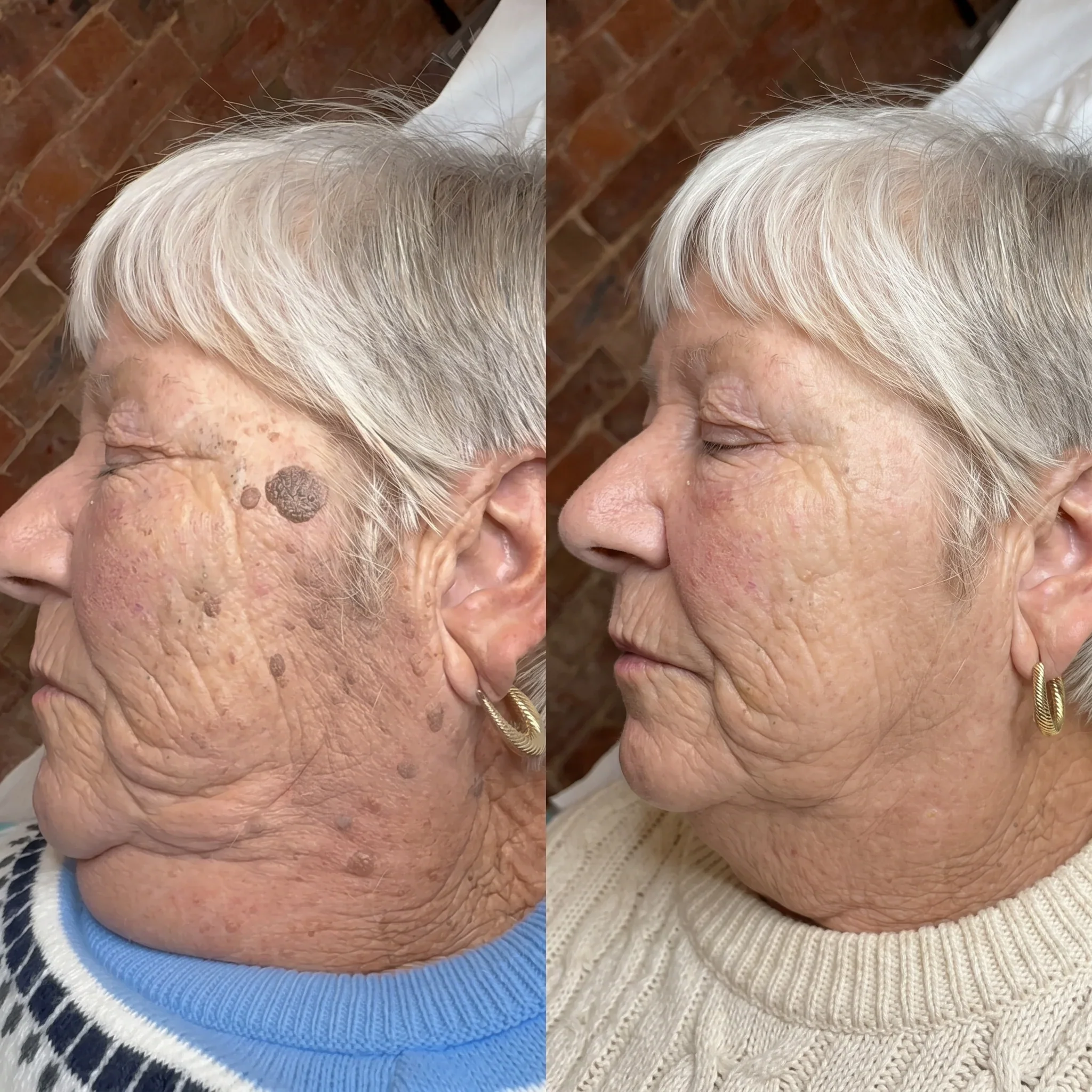 Customer result photo