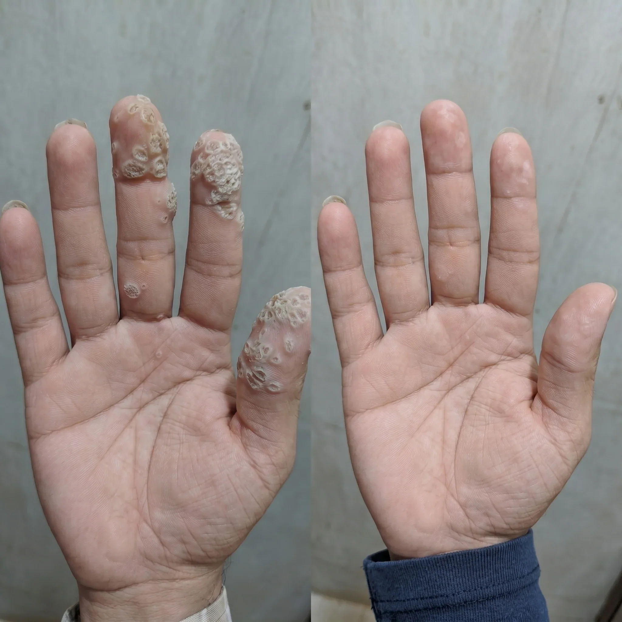 Customer result photo