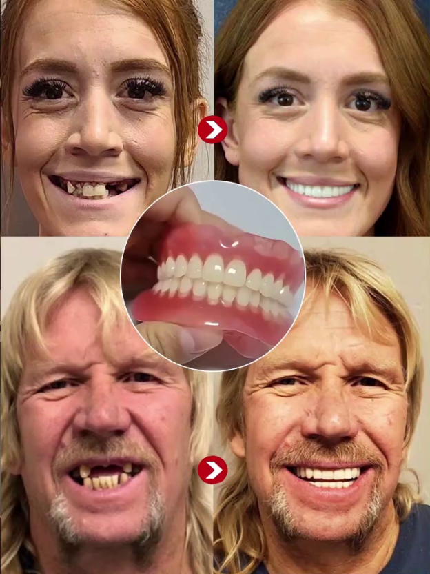 Comfortable and realistic full-mouth dental braces